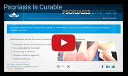 Psoriasis is Curable
